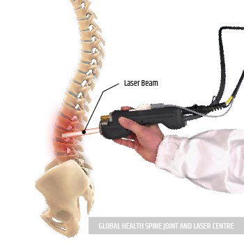 LASER TREATMENT | Global Health