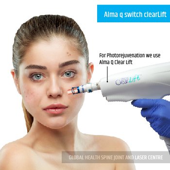 Alma q switch clearLift | Global Health