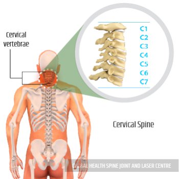 Recovered Cervical bone | Global Health