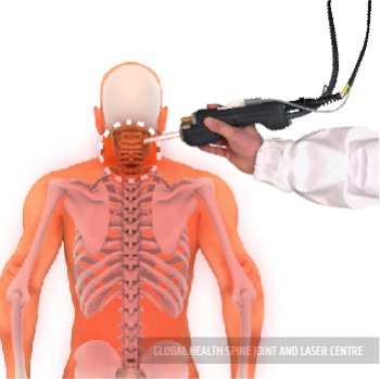 LASER TREATMENT | Global Health
