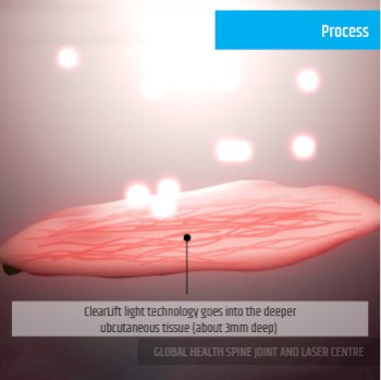PROCESS | Global Health