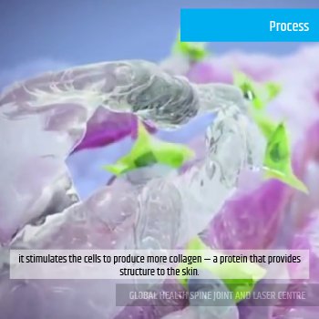 PROCESS | Global Health