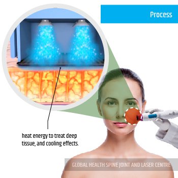 PROCESS | Global Health