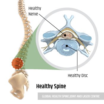 HEALTHY SPINE | Global Health