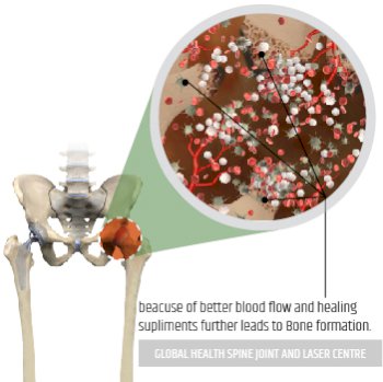 BONE FORMATION | Global Health
