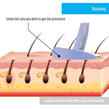 Shaving | Global Health