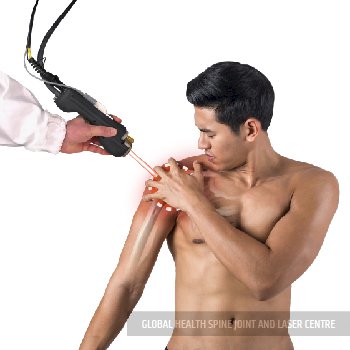 LASER TREATMENT | Global Health