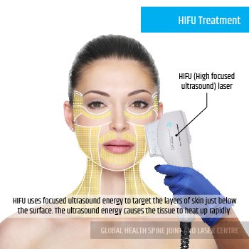 HIFU TREATMENT | Global Health
