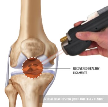 HEALTHY LIGAMENTS | Global Health