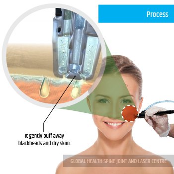 SKIN CLEANING  | Global Health