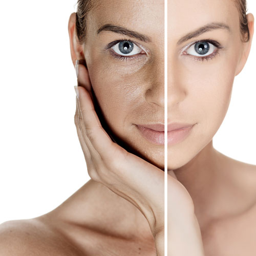 Skin Rejuvenation  | Global Health
