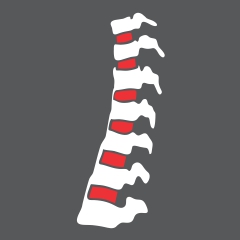 Thoracic Spondylitis