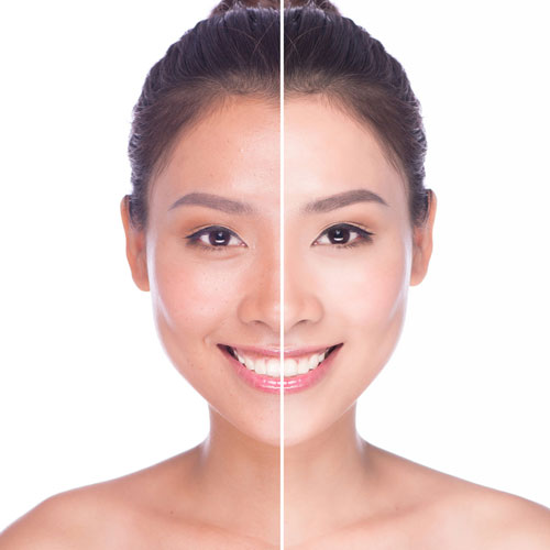 Skin Brightening | Global Health