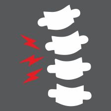 Ankylosing Spondylitis 