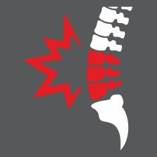 Back Pain