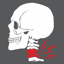 Cervical Pain