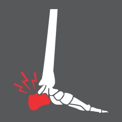 Heel Pain