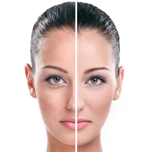 Photo Rejuvenation | Global Health
